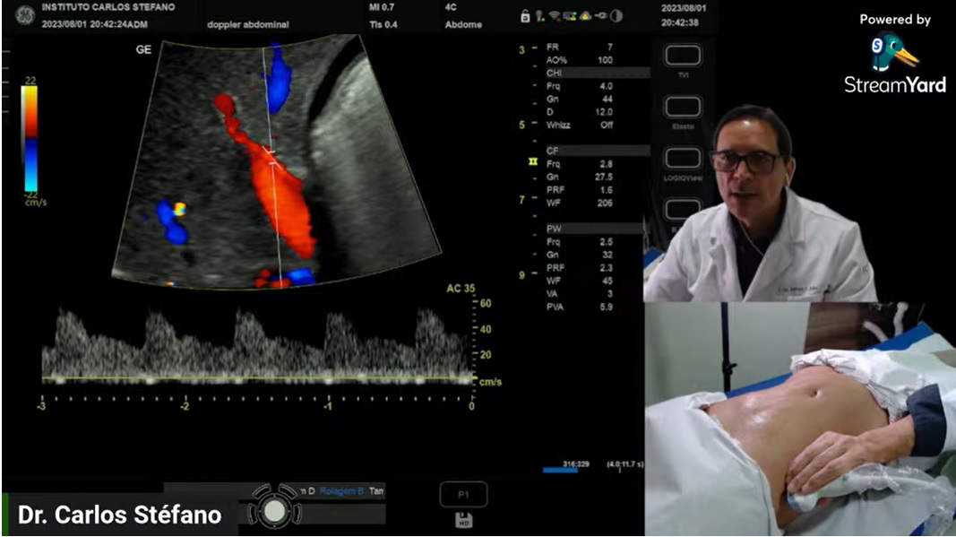 Pós graduação Ultrassom Vascular com Doppler