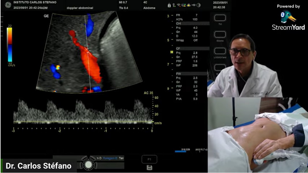 Curso Individual Ultrassom Vascular com Doppler de Carótidas e Vertebrais + Doppler Abdominal