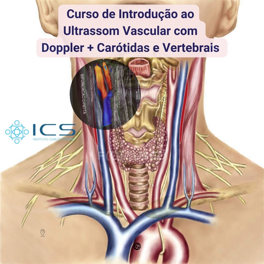 Curso de Introdução ao Ultrassom Vascular com Doppler + Carótidas e Vertebrais