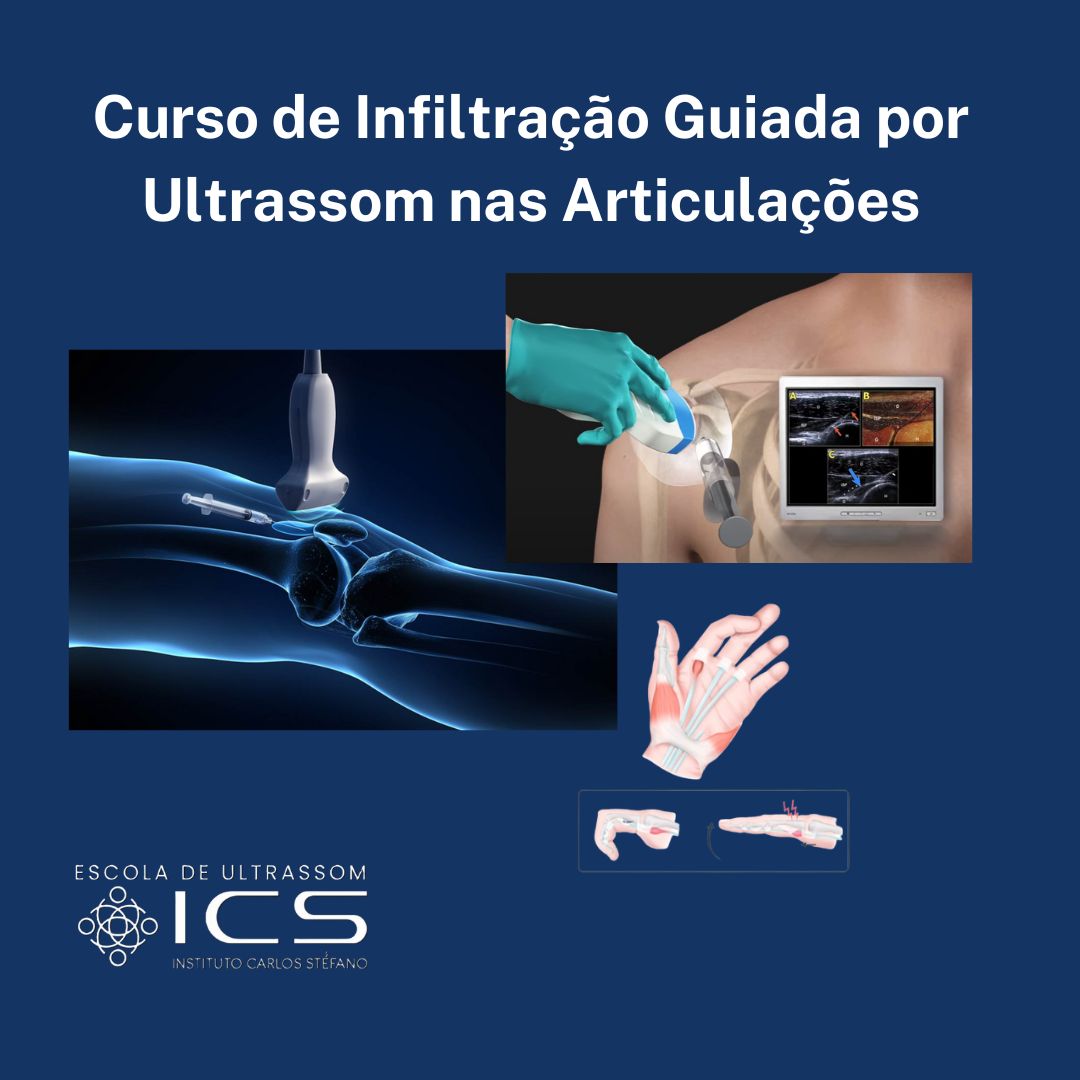 Curso de Infiltração Guiada por Ultrassom nas Articulações