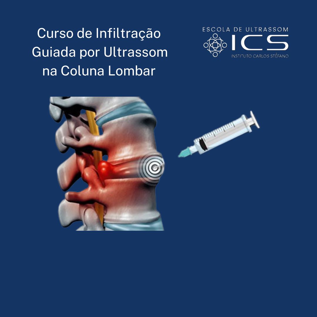 Curso de Infiltração Guiada por Ultrassom na Coluna Lombar
